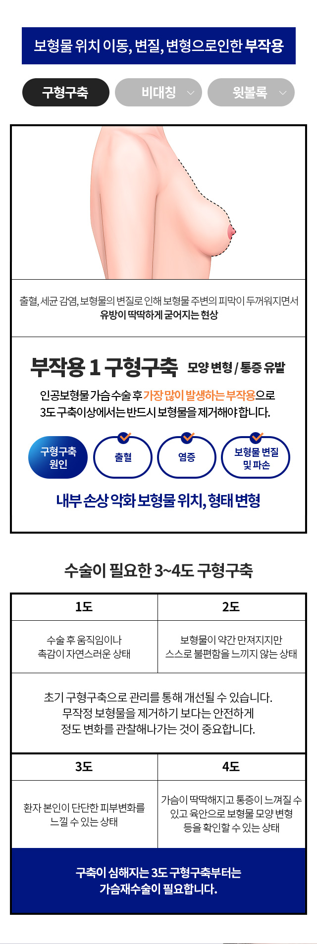 구형구축